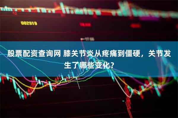 股票配资查询网 膝关节炎从疼痛到僵硬，关节发生了哪些变化？